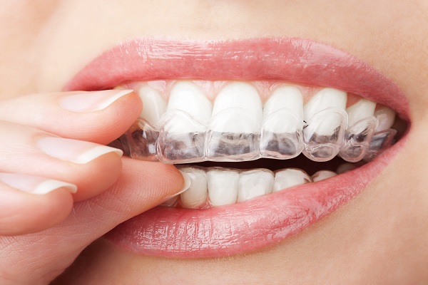 What Can An Invisalign Dentist® Do For Me?