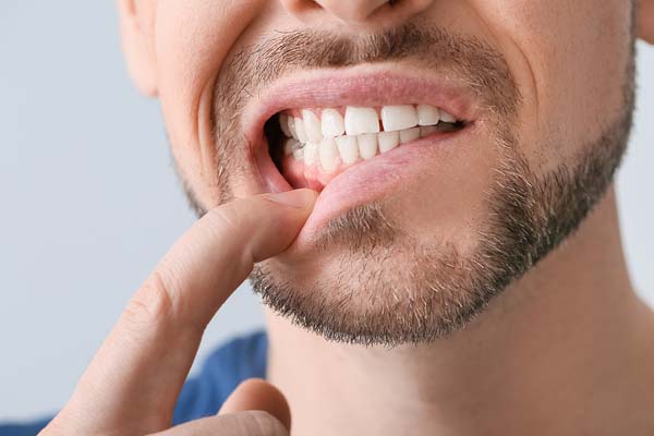 What Are The Signs Of Gum Disease?